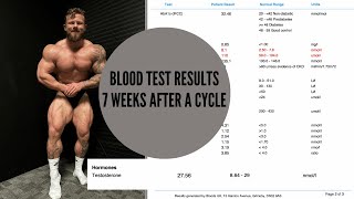 Blood Test Results 7 weeks After Steroid Use 250lb physique update [upl. by Staford376]