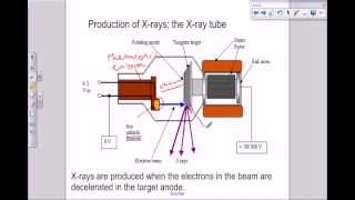 A level Medical Physics  X rays the X ray tube [upl. by Jillie]