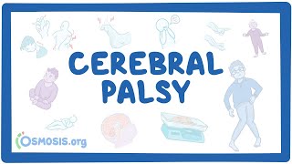 Cerebral palsy CP  causes symptoms diagnosis treatment pathology [upl. by Ladnek]