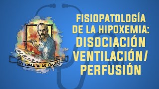 Hipoxemia Disociación ventilaciónperfusión [upl. by Corabel31]