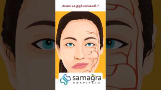 Understanding Hemifacial Spasm HemifacialSpasm DrKNeeraja Neurologist SamagraHospitals Guntur [upl. by Simson]