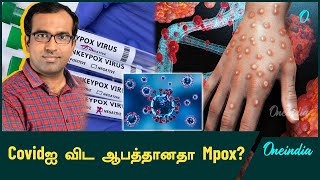 Mpoxல் இருந்து எப்படி தப்பிக்கலாம்  DrFarook Abdullah  Oneindia Tamil [upl. by Nnylyram]