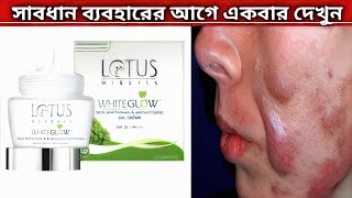 Lotus Herbals Cream Review  Lotus Herbals WhiteGlow Skin Whitening And Brightening Gel Cream [upl. by Gignac]