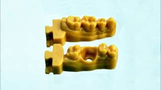 video modello con moncone sfilabile dentale stampante 3d odontotecnico [upl. by Bough]