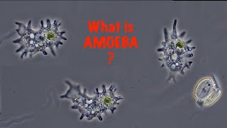 What is Amoeba [upl. by Arevle358]