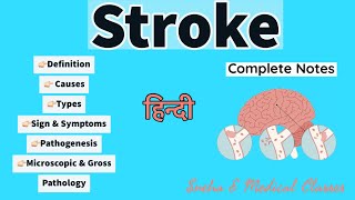 Stroke Pathology  Types  Causes  Sign amp symptoms  Gross amp Microscopic Pathogenesis [upl. by Jessa]