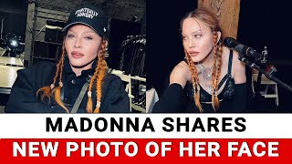 Madonna shares new photo of her face [upl. by Okomom91]