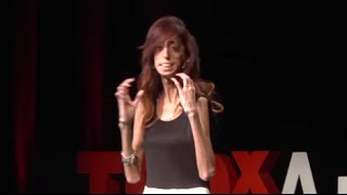 How do you define yourself  Lizzie Velasquez  TEDxAustinWomen [upl. by Gracia920]