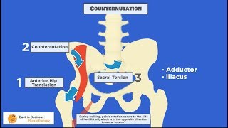 Pelvic Malalignment [upl. by Sudnac]