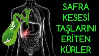 SAFRA KESESİ TAŞLARINI ERİTEN KÜRLER [upl. by Trust]