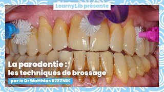 🦷 La parodontie  les différentes techniques de brossage avec le Dr Matthias RZEZNIK [upl. by Yahsal14]