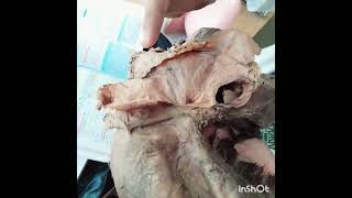 ।।Diaphragm।।Thorax।।Bangla Demonstration।। [upl. by Shuman722]