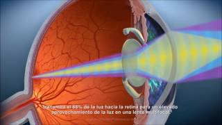 Lentes Trifocales para la corrección de Vista Cansada [upl. by Nodal]