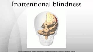 Inattentional blindness [upl. by Orthman]