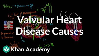 Valvular heart disease causes  Circulatory System and Disease  NCLEXRN  Khan Academy [upl. by Inness870]