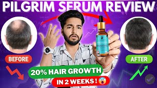 Pilgrim Redensyl and Anagain Advanced Hair Growth Serum Review [upl. by Lavella250]