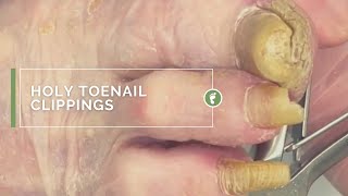 HOLY TOENAIL CLIPPINGS [upl. by Antonetta]