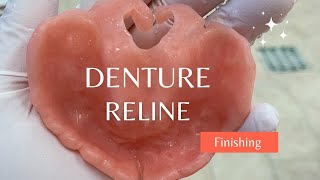 Permanent Denture Relines [upl. by Bradski]