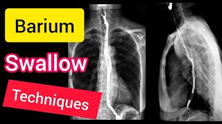 Barium Swallow Contrast Xray technique explained English [upl. by Tamma]