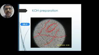 Laboratory diagnosis of dermatophytes [upl. by Eeladnerb]