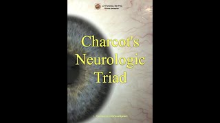 Multiple Sclerosis Charcots Neurologic Triad [upl. by Jabe]