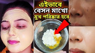 বেসনের সাথে এই জিনিসটা মিশিয়ে লাগাও মুখ পরিষ্কার থাকবেমুখের কালো দাগ দূর করার উপায়Dtan pack [upl. by Aurita797]