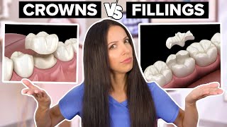 Dental Crowns Vs Dental Fillings Whats the Difference [upl. by Essined]