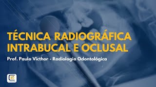 RADIOLOGIA 2  BANCA VUNESP [upl. by Evol945]