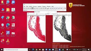 Análisis de imágenes Tricrómica de Masson con Fiji ImageJCuantificación de colágenoMétodo II 2021 [upl. by Bea887]