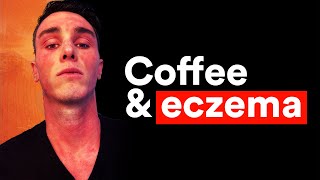 The WORST Drink for Eczema Sufferers and Its Not What You Think [upl. by Marchal]