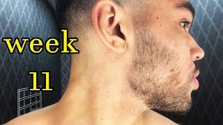 My Minoxidil Beard Journey  Week 11  Filling Out [upl. by Whitcher1]