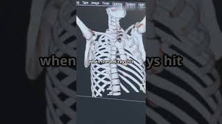 How XRays Works Explained under 60 Seconds [upl. by Noirda783]