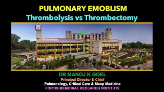 Thrombolysis vs Thrombectomy in Pulm Embolism [upl. by Connor893]