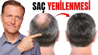 Saç Kaybıyla Mücadele 12 Güçlü ve Doğal Yöntem  DrBerg Türkçe [upl. by Myers978]