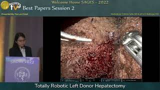 Totally Robotic Left Donor Hepatectomy [upl. by Ynneh291]