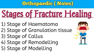 Stages of Fracture Healing [upl. by Iolanthe992]