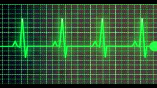 Heartbeat sound effect  normal speed [upl. by Eltotsira680]