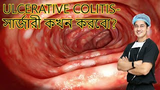 Ulcerative colitis সার্জারী কখন করবো [upl. by Bain]