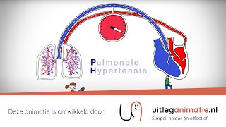 Uitleganimatie  VUmc Pulmonale Hypertensie [upl. by Maddocks]