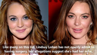 13 of the most drastic celebrity plastic surgeries [upl. by Anawik144]