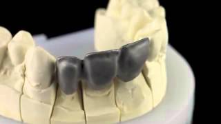 Металл Ceramill Sintron  революция в CADCAM [upl. by Danya601]