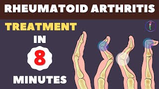 Rheumatoid Arthritis Treatment  New Medicines and Updates [upl. by Goulette]