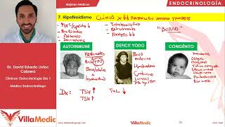 Hipotiroidismo  Endocrinología  Villamedic Clínicas 2021 [upl. by Levins]