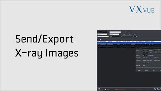 VXvue Quick Guide 05 Send and Export Xray Image [upl. by Nylkoorb826]