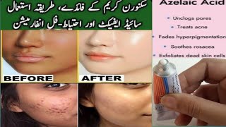 skinoren cream use and side effects  How to use azelaic acid [upl. by Niwle]