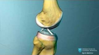 Knee Ligament Anatomy Animation [upl. by Bettine]