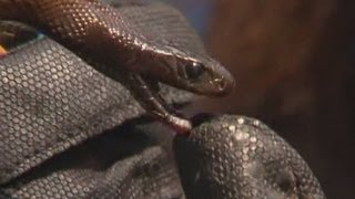 Australian teenager survives worlds most venomous snake bite [upl. by Aurea67]