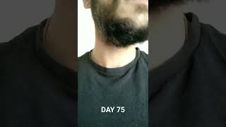 Patchy beard 75 days growth 32 yo 2024 [upl. by Tillford510]