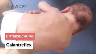 Galantreflex  Frühkindliche Reflexe  AMBOSS Video [upl. by Ojeitak]