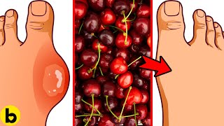 7 POWERFUL Reasons Of Eating Cherries Every Day [upl. by Eyeleen]